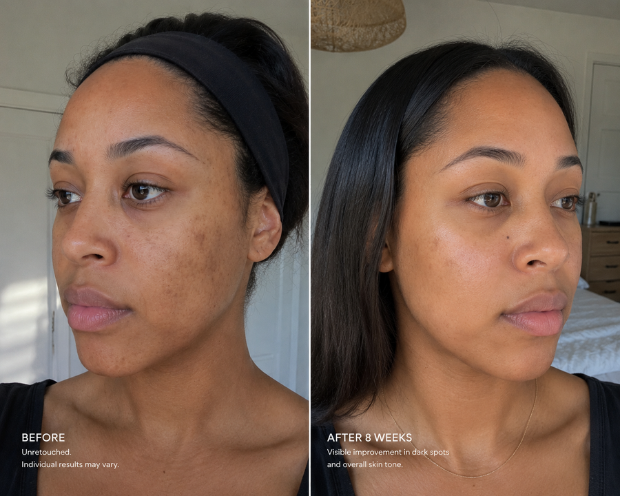 Mandelic Serum