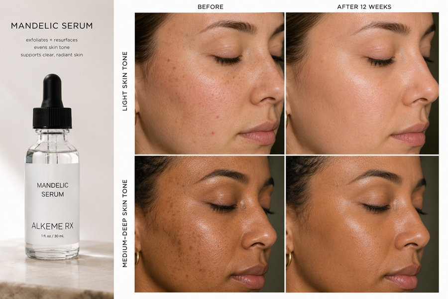Mandelic Serum